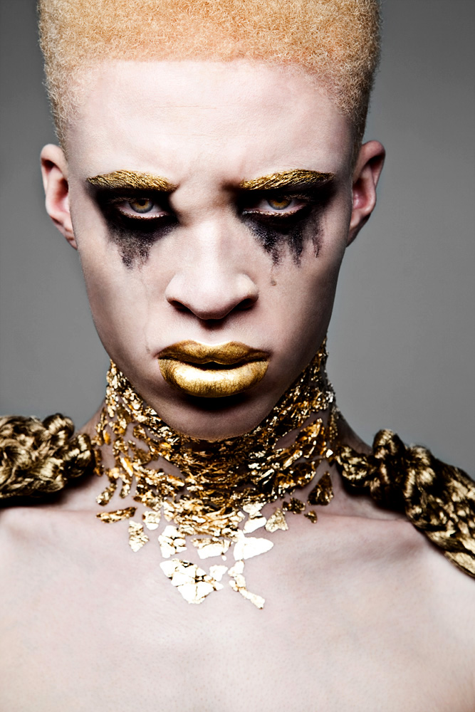 Model nose albino shaun Shaun Ross: